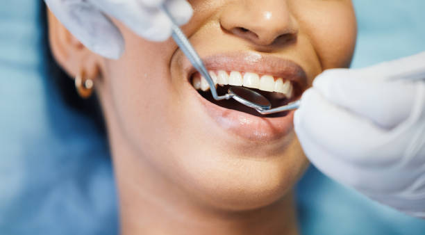 Best Emergency Treatment for Dental Infections or Abscesses in Burlington, CO