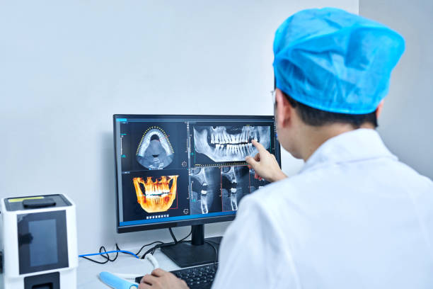 Best Emergency Dental Care for Broken or Chipped Teeth in Burlington, CO